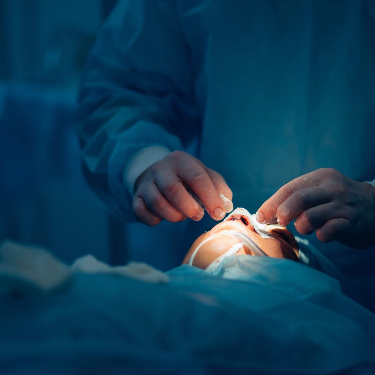 Surgeon and his assistant performing cosmetic surgery on nose in hospital operating room. Nose reshaping, augmentation. Rhinoplasty.