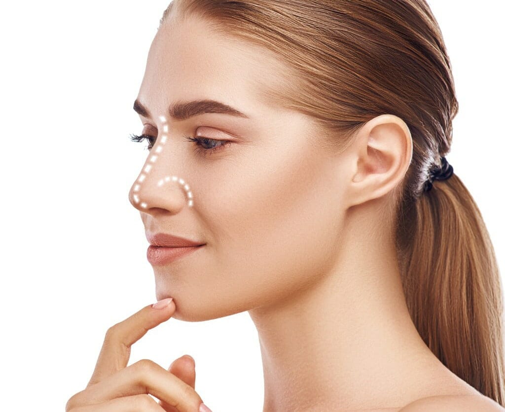 Rhinoplasty in London